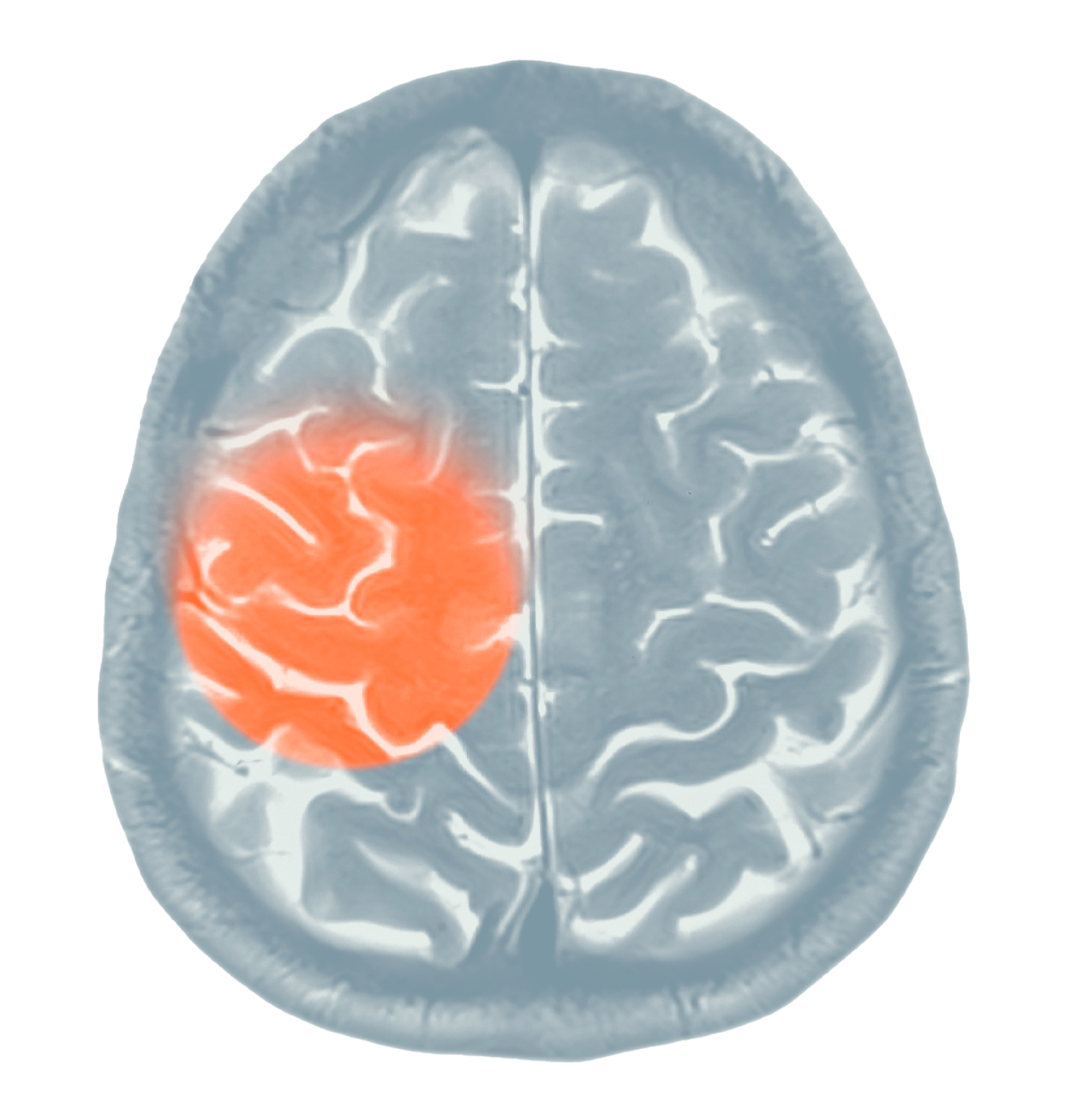 Illustration of brain with a section highlighted.